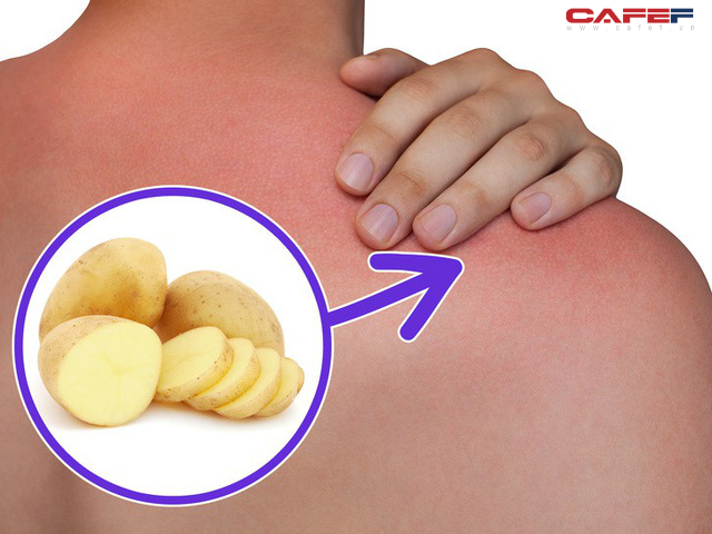 11 công dụng hữu hiệu của khoai tây có thể bạn chưa bao giờ biết - Ảnh 2.