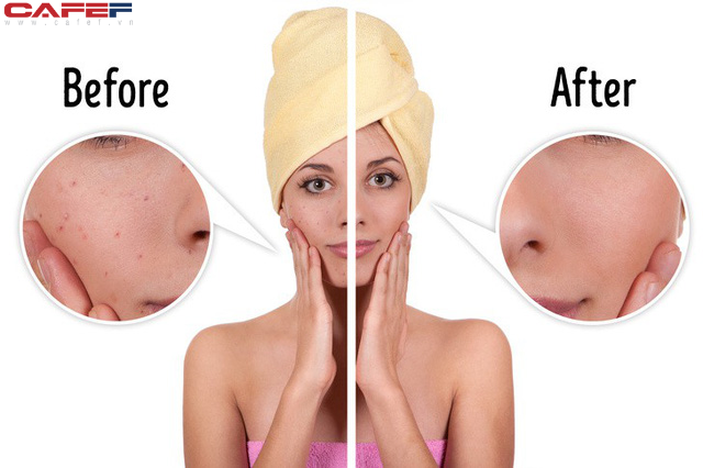 11 công dụng hữu hiệu của khoai tây có thể bạn chưa bao giờ biết - Ảnh 9.